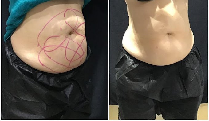 a person's stomach with a drawing on it