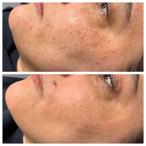 a woman's face with a piercing