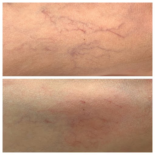a close up of a person's skin