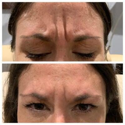 a collage of a woman's face