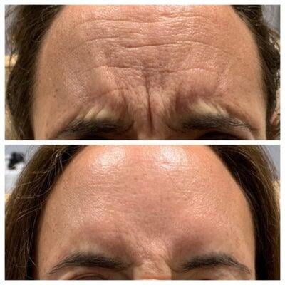 a collage of a person's face
