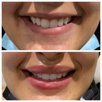 a collage of a woman's teeth