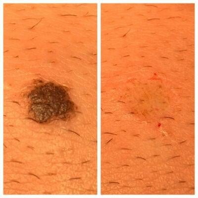 a close up of a skin