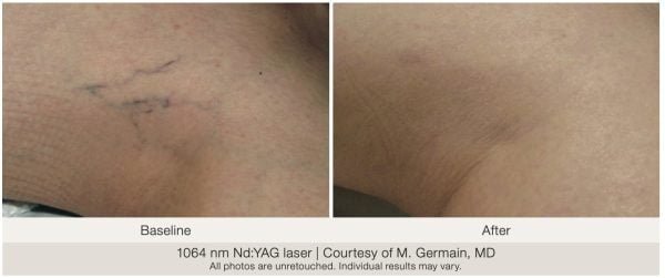 a close-up of a person's skin