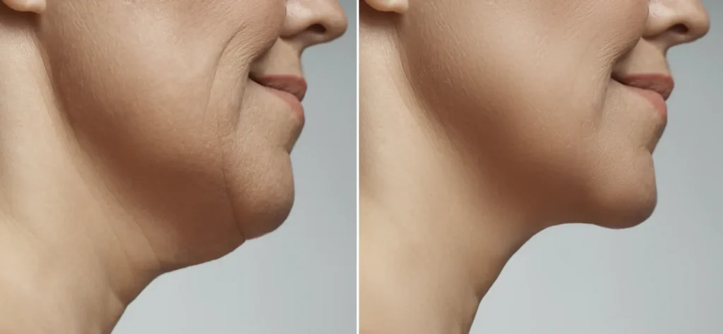 a close up of a woman's face