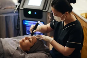 10 Surprising Benefits of PRP Microneedling for Skin Health - PRP Microneedling in Portland