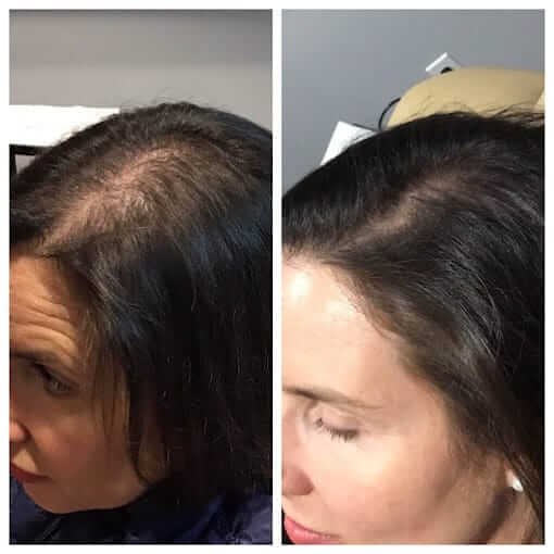 portland hair restoration treatments