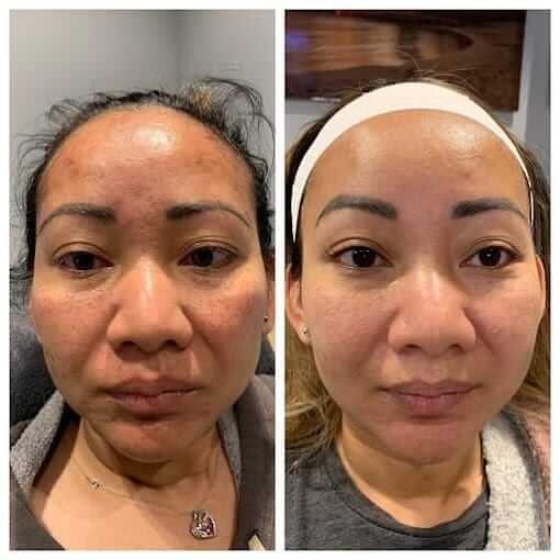 a collage of a woman with a white headband