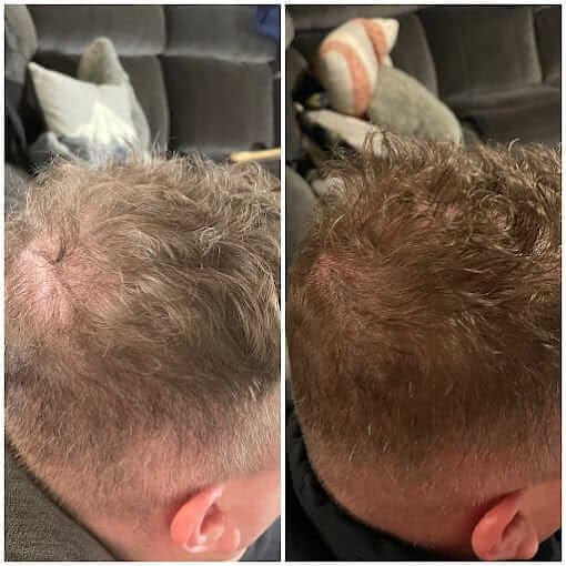 portland hair restoration treatments